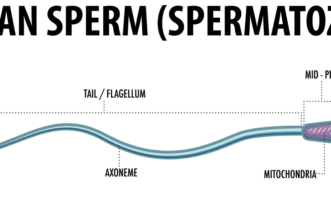 Azoospermia is a medical condition