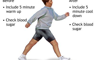 The Role of Exercise in Diabetes Control